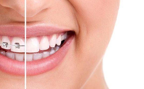 LAS ENFERMEDADES MÁS COMUNES QUE ATIENDEN LOS DENTISTAS EN LEÓN