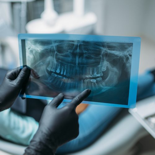 Endondoncia Endondoncia