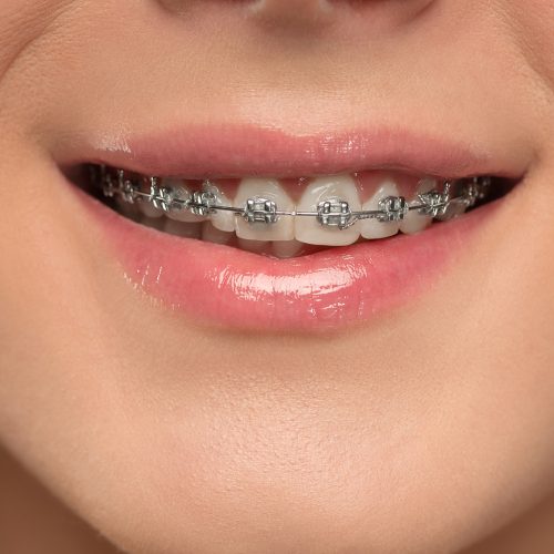 Ortodoncia y Ortopedia Ortodoncia y Ortopedia