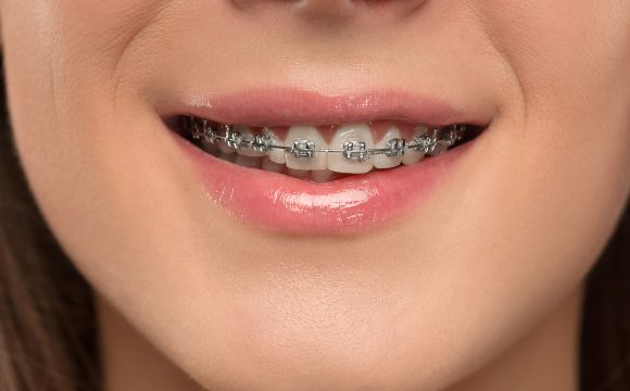 Ortodoncia y Ortopedia