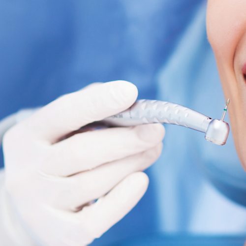 BLANQUEAMIENTO DENTAL EN LEÓN, TÉCNICA PARA DEVOLVER VITALIDAD A LA SONRISA BLANQUEAMIENTO DENTAL EN LEÓN, TÉCNICA PARA DEVOLVER VITALIDAD A LA SONRISA
